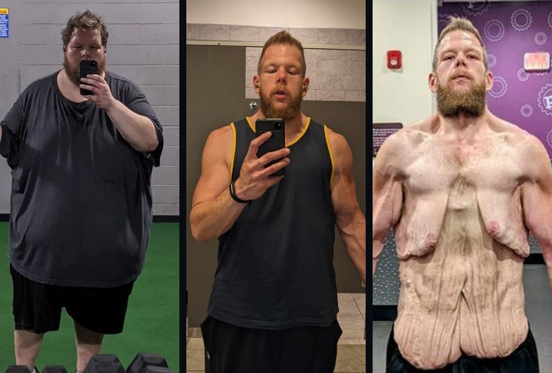 OMG: Man shows incredible transformation after losing more than 160kg ...